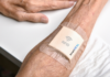SmartHEAL: así es el sensor para apósitos que indica el nivel de curación de una herida
